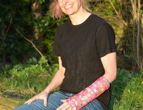 Brighten Up Your Plaster Cast With These Funky Cast Covers