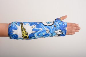 broken arm cast cover and protector