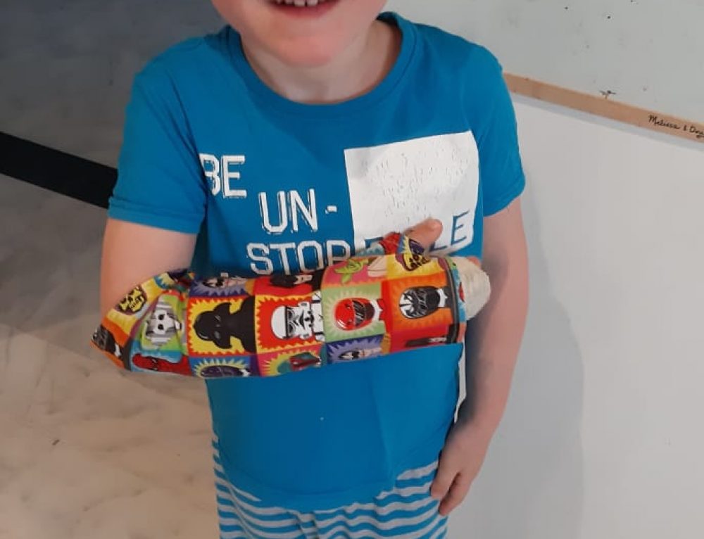 Cast covers Europe and Worldwide Supersleeves cast covers